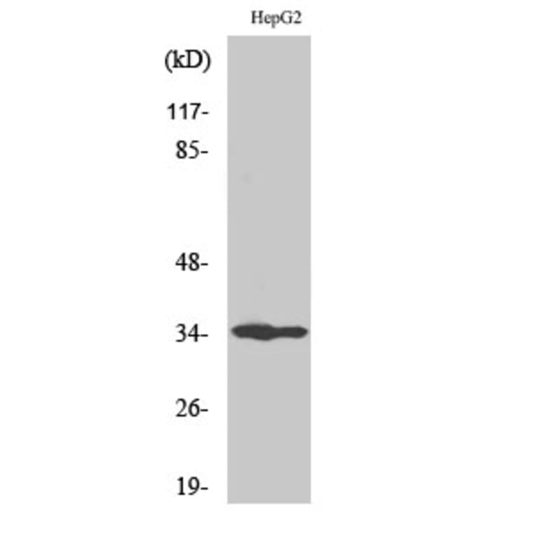 Western Blot - Anti-UNG Antibody (C10355) - Antibodies.com