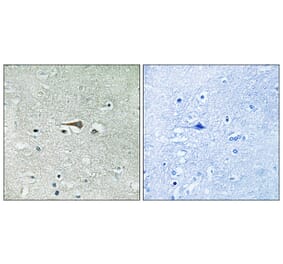 Immunohistochemistry - Anti-TTK Antibody (B8197) - Antibodies.com