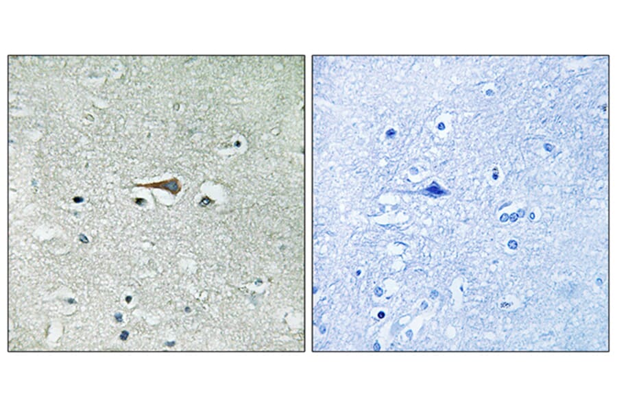 Immunohistochemistry - Anti-TTK Antibody (B8197) - Antibodies.com