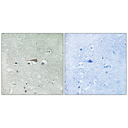 Immunohistochemistry - Anti-TTK Antibody (B8197) - Antibodies.com