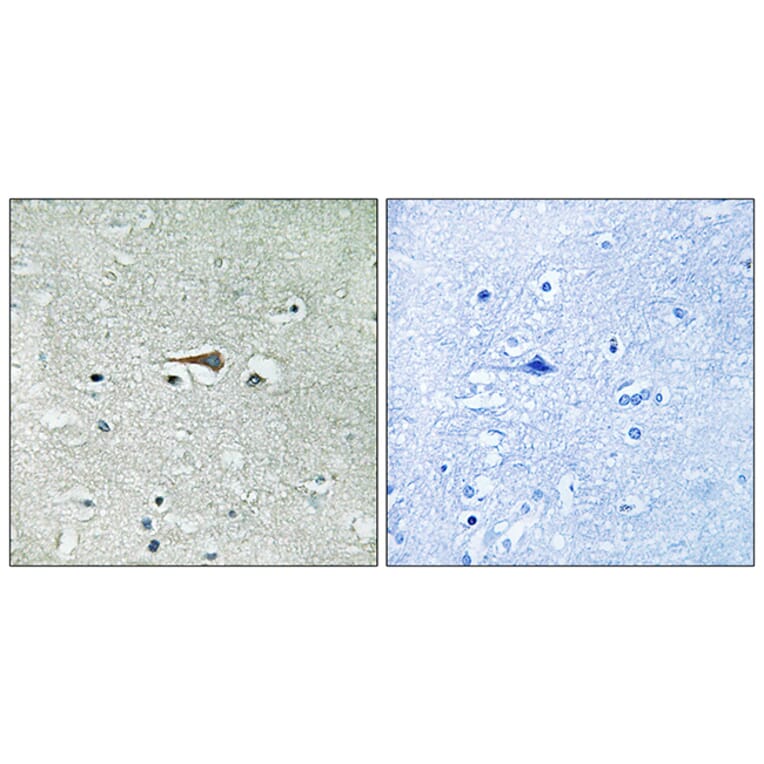 Immunohistochemistry - Anti-TTK Antibody (B8197) - Antibodies.com