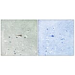 Immunohistochemistry - Anti-TTK Antibody (B8197) - Antibodies.com