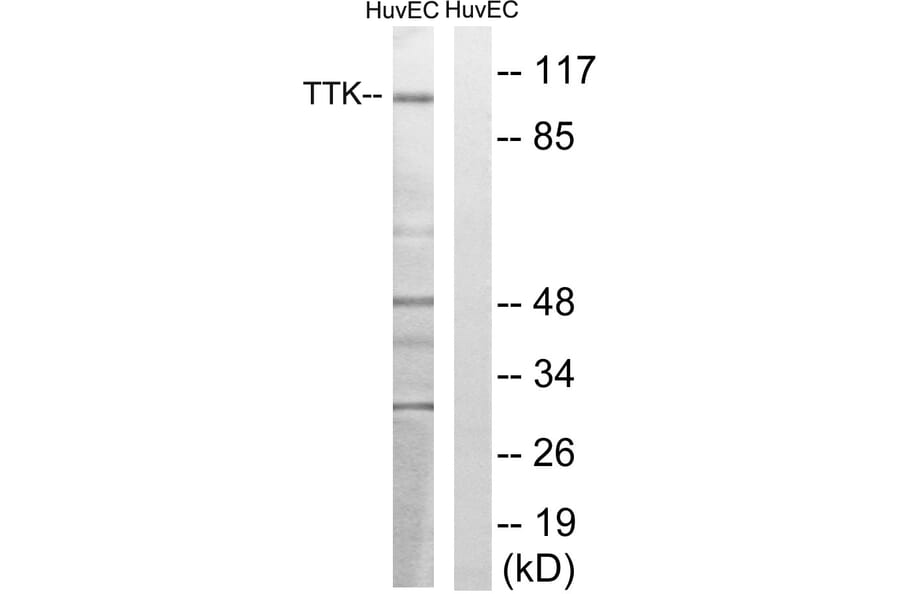 Western Blot - Anti-TTK Antibody (B8197) - Antibodies.com