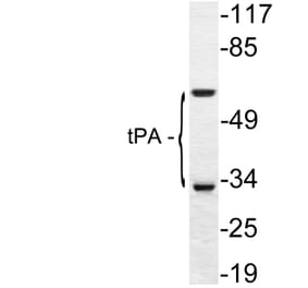 Western Blot - Anti-tPA Antibody (R12-2384) - Antibodies.com