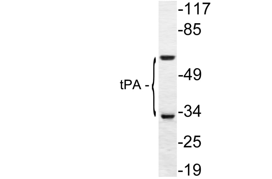 Western Blot - Anti-tPA Antibody (R12-2384) - Antibodies.com