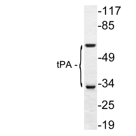 Western Blot - Anti-tPA Antibody (R12-2384) - Antibodies.com