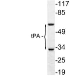 Western Blot - Anti-tPA Antibody (R12-2384) - Antibodies.com