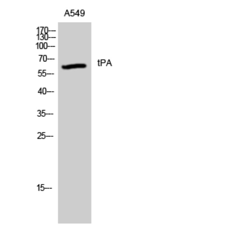 Western Blot - Anti-tPA Antibody (R12-2384) - Antibodies.com