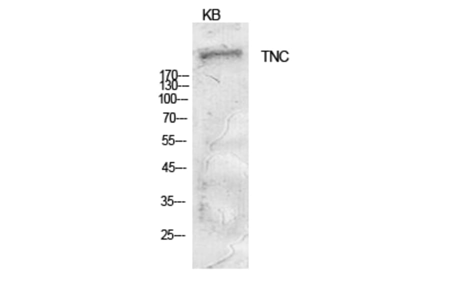 Western Blot - Anti-TNC Antibody (C30057) - Antibodies.com