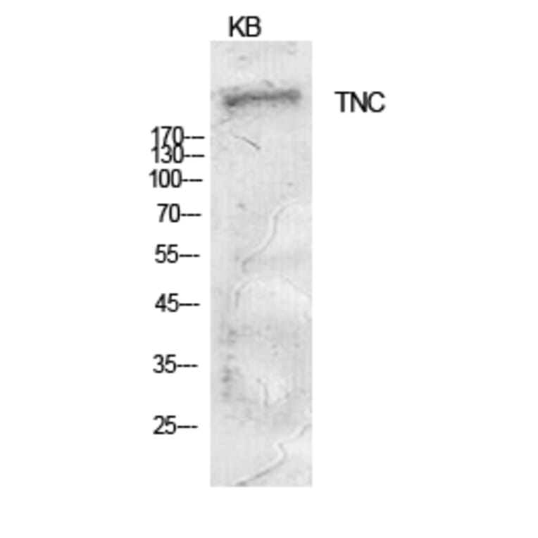 Western Blot - Anti-TNC Antibody (C30057) - Antibodies.com