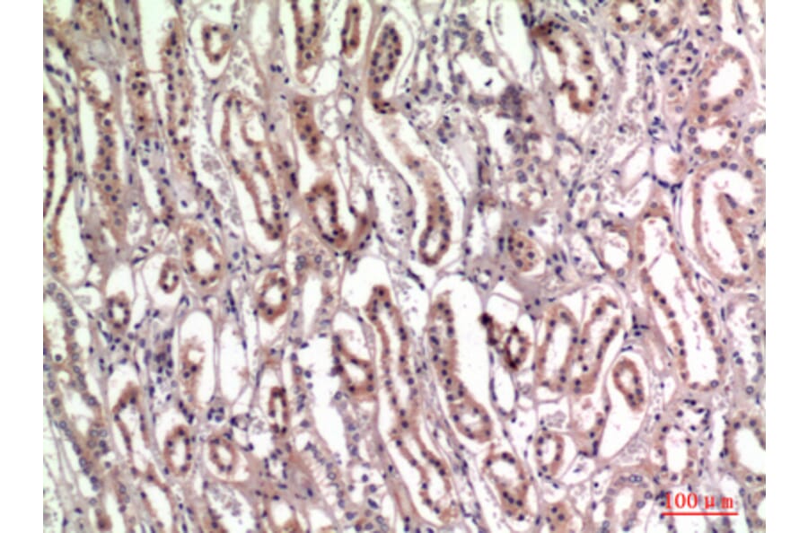 Immunohistochemistry - Anti-TNC Antibody (C30057) - Antibodies.com