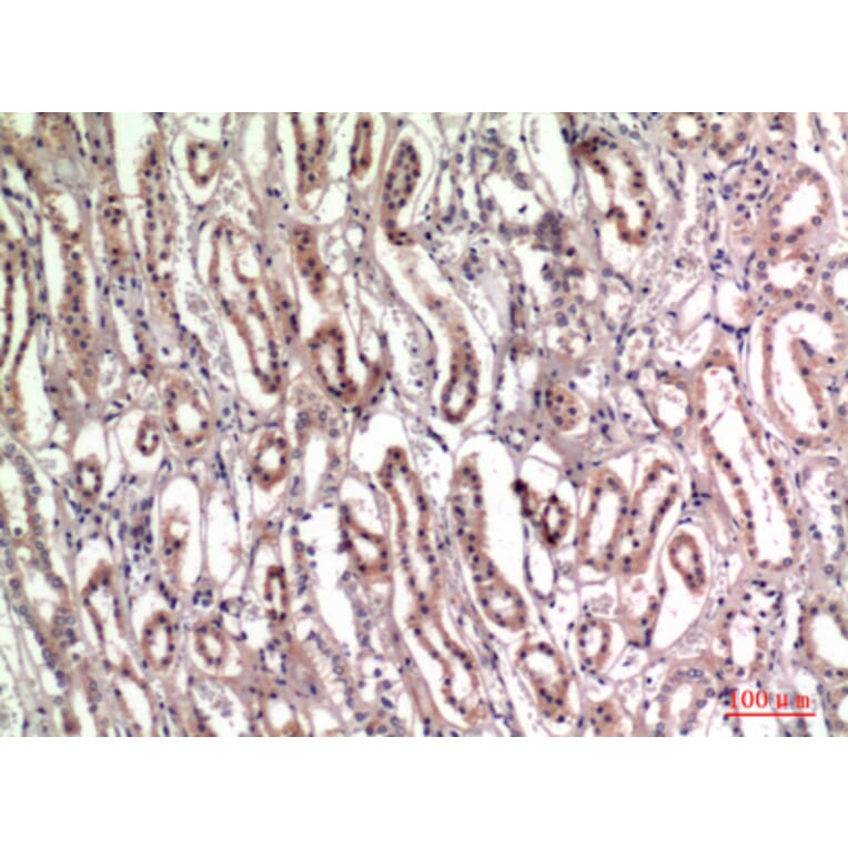 Immunohistochemistry - Anti-TNC Antibody (C30057) - Antibodies.com