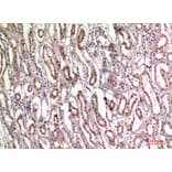 Immunohistochemistry - Anti-TNC Antibody (C30057) - Antibodies.com