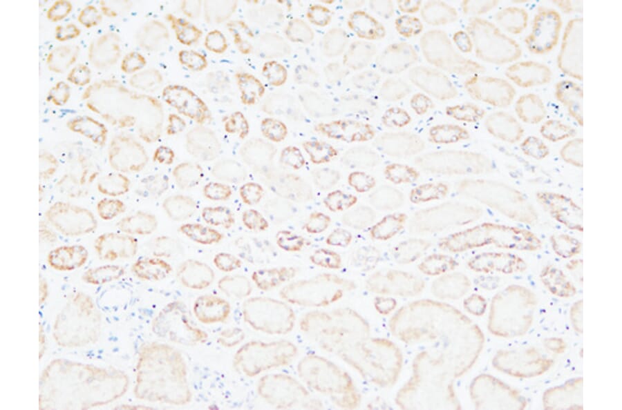 Immunohistochemistry - Anti-TNC Antibody (C30057) - Antibodies.com