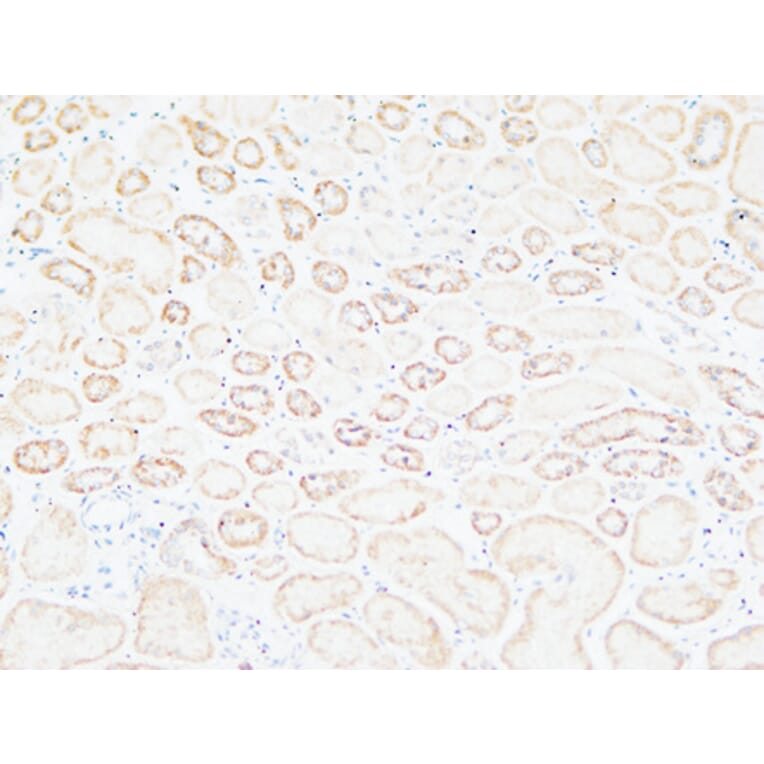 Immunohistochemistry - Anti-TNC Antibody (C30057) - Antibodies.com