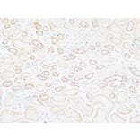 Immunohistochemistry - Anti-TNC Antibody (C30057) - Antibodies.com