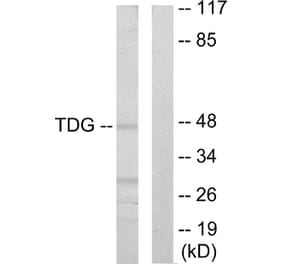 Western Blot - Anti-TDG Antibody (C10996) - Antibodies.com