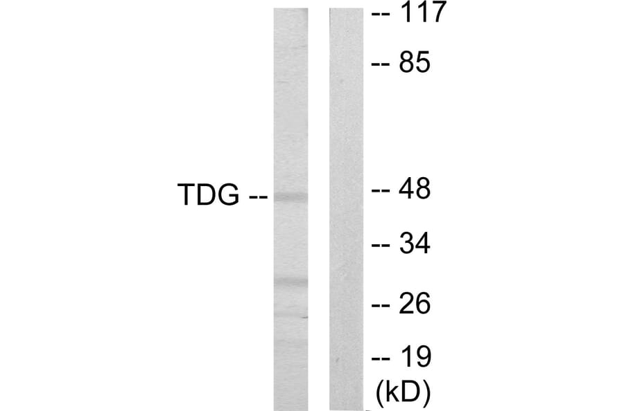 Western Blot - Anti-TDG Antibody (C10996) - Antibodies.com