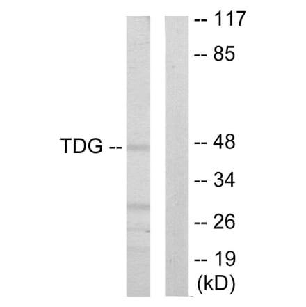 Western Blot - Anti-TDG Antibody (C10996) - Antibodies.com