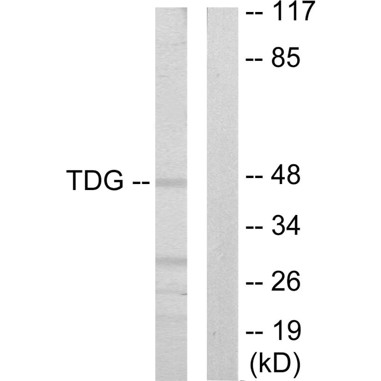 Western Blot - Anti-TDG Antibody (C10996) - Antibodies.com