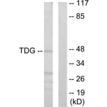 Western Blot - Anti-TDG Antibody (C10996) - Antibodies.com