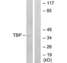 Western Blot - Anti-TBP Antibody (C10435) - Antibodies.com
