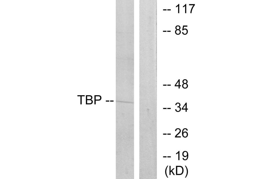 Western Blot - Anti-TBP Antibody (C10435) - Antibodies.com