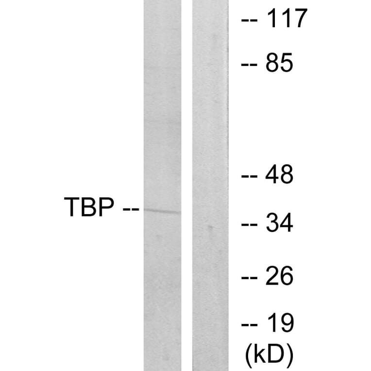 Western Blot - Anti-TBP Antibody (C10435) - Antibodies.com