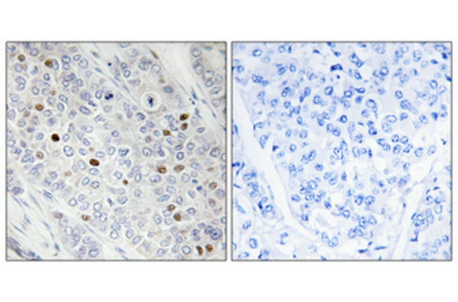 Immunohistochemistry - Anti-TBP Antibody (C10435) - Antibodies.com
