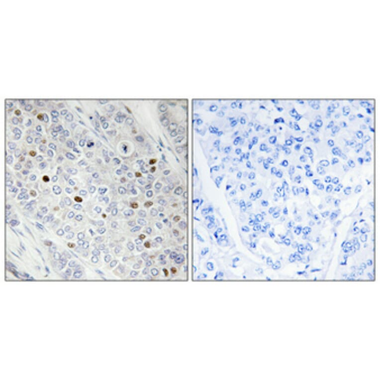 Immunohistochemistry - Anti-TBP Antibody (C10435) - Antibodies.com