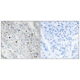 Immunohistochemistry - Anti-TBP Antibody (C10435) - Antibodies.com