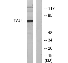 Western Blot - Anti-Tau Antibody (B7247) - Antibodies.com