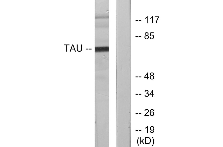 Western Blot - Anti-Tau Antibody (B7247) - Antibodies.com