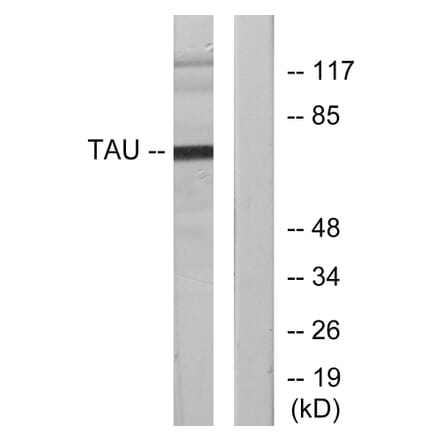 Western Blot - Anti-Tau Antibody (B7247) - Antibodies.com