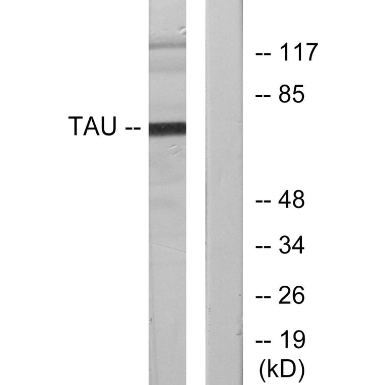 Western Blot - Anti-Tau Antibody (B7247) - Antibodies.com