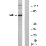 Western Blot - Anti-Tau Antibody (B7247) - Antibodies.com