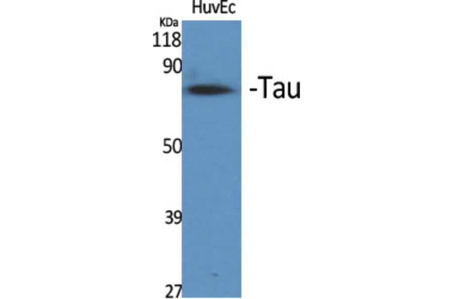 Western Blot - Anti-Tau Antibody (B7247) - Antibodies.com