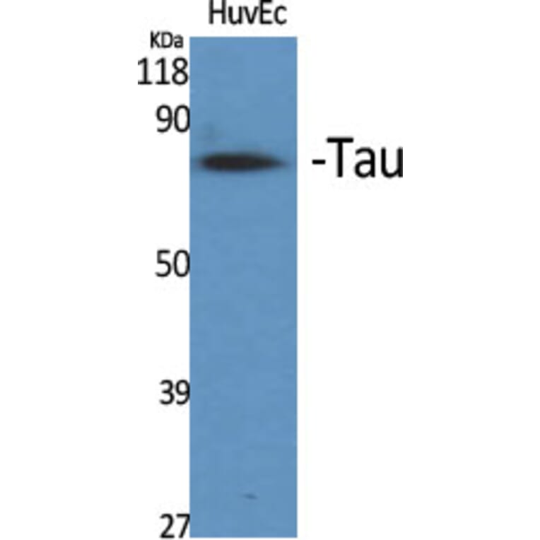 Western Blot - Anti-Tau Antibody (B7247) - Antibodies.com