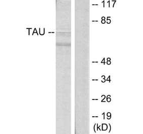 Western Blot - Anti-Tau Antibody (B7241) - Antibodies.com