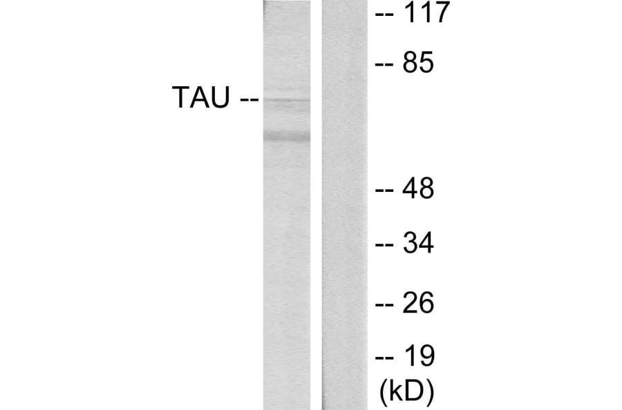 Western Blot - Anti-Tau Antibody (B7241) - Antibodies.com