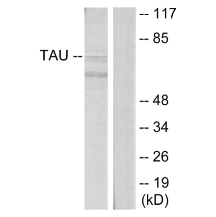 Western Blot - Anti-Tau Antibody (B7241) - Antibodies.com