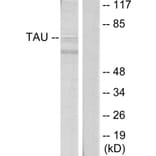 Western Blot - Anti-Tau Antibody (B7241) - Antibodies.com