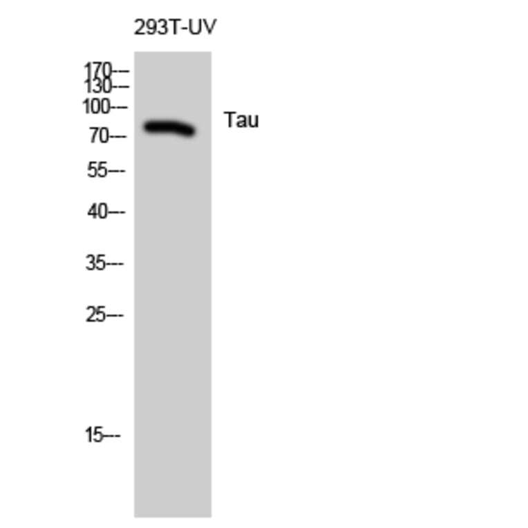 Western Blot - Anti-Tau Antibody (B7241) - Antibodies.com