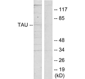 Western Blot - Anti-Tau Antibody (B7239) - Antibodies.com