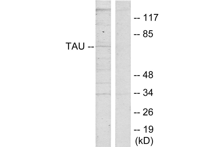 Western Blot - Anti-Tau Antibody (B7239) - Antibodies.com