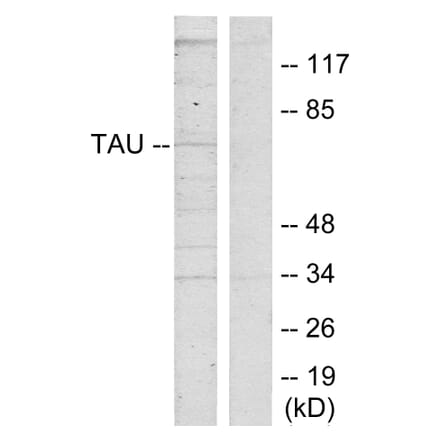 Western Blot - Anti-Tau Antibody (B7239) - Antibodies.com