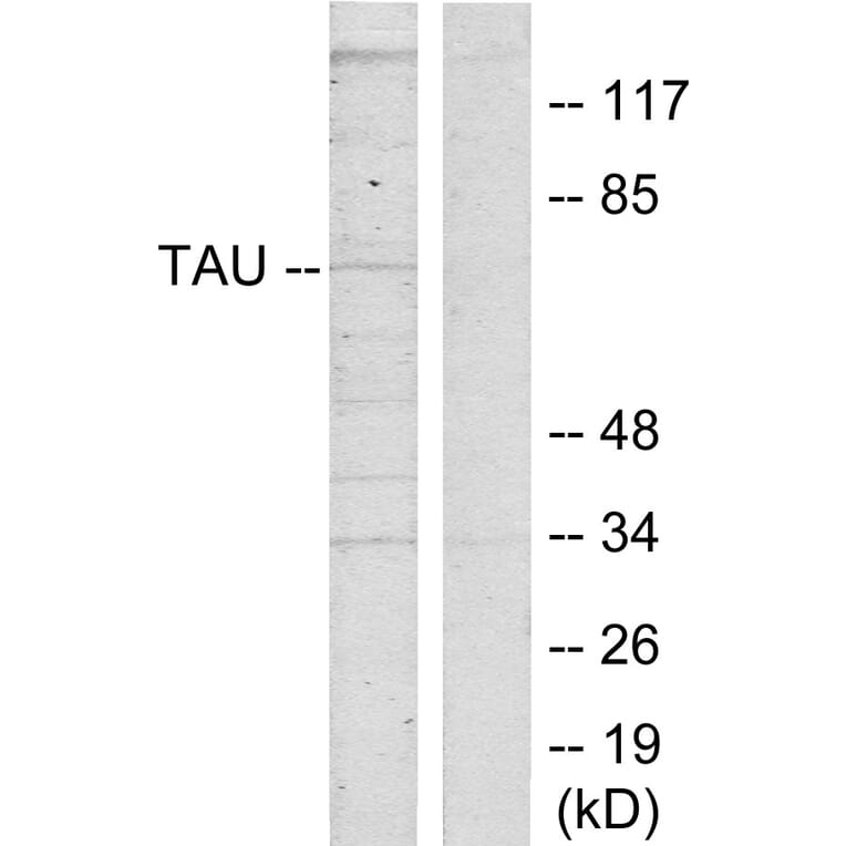 Western Blot - Anti-Tau Antibody (B7239) - Antibodies.com