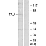 Western Blot - Anti-Tau Antibody (B7239) - Antibodies.com