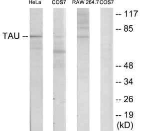 Western Blot - Anti-Tau Antibody (B7238) - Antibodies.com