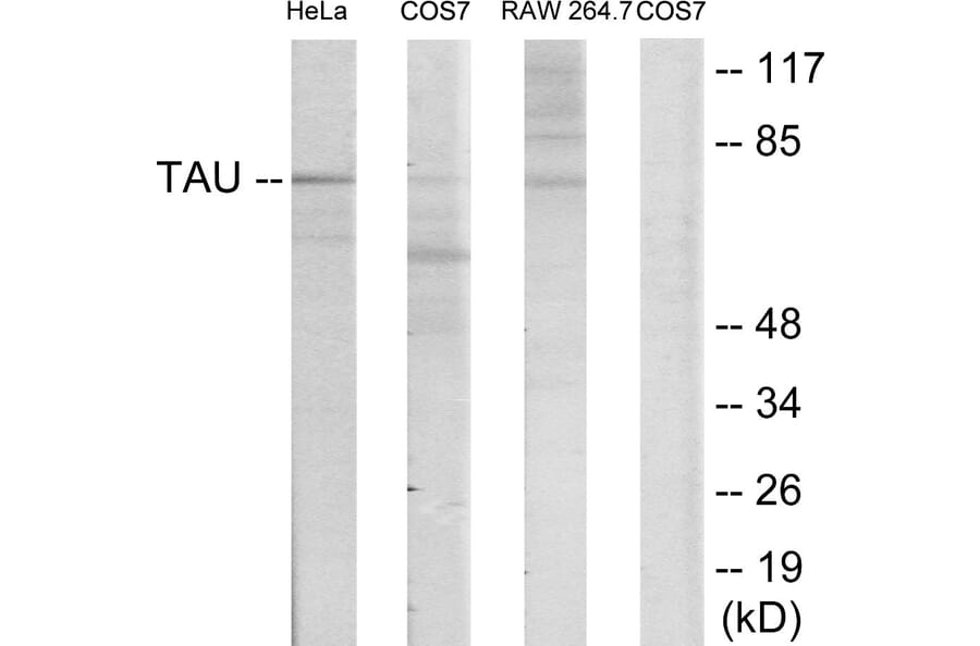 Western Blot - Anti-Tau Antibody (B7238) - Antibodies.com